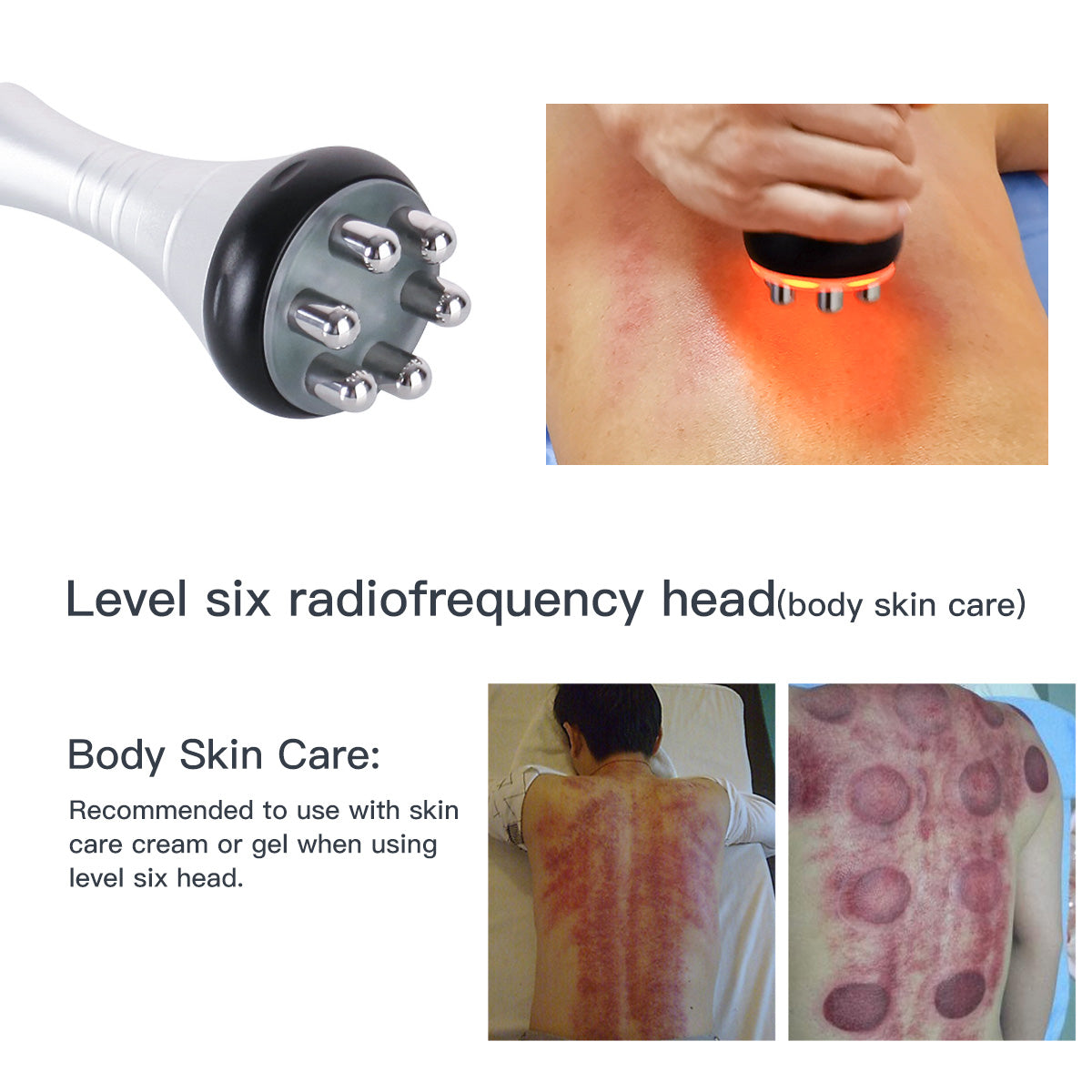 SQ47B Pro – 6-i-1 enhet med 40K kavitation, RF, vakuum, EMS och laser